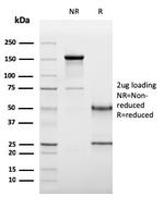 CD19 (B-Lymphocyte Marker) Antibody in SDS-PAGE (SDS-PAGE)