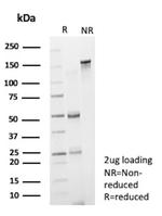 CD19 (B-Lymphocyte Marker) Antibody in SDS-PAGE (SDS-PAGE)