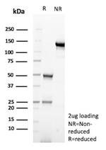 CD83 (Marker of Activated Dendritic Cells) Antibody in SDS-PAGE (SDS-PAGE)