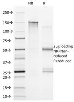 CD20/MS4A1 (B-Cell Marker) Antibody in SDS-PAGE (SDS-PAGE)