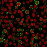 CD20/ MS4A1 (B-Cell Marker) Antibody in Immunocytochemistry (ICC/IF)