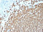 CD20/ MS4A1 (B-Cell Marker) Antibody in Immunohistochemistry (Paraffin) (IHC (P))
