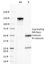 CD20/ MS4A1 (B-Cell Marker) Antibody in SDS-PAGE (SDS-PAGE)