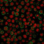 CD20/MS4A1 (B-Cell Marker) Antibody in Immunocytochemistry (ICC/IF)