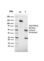 CD20/MS4A1 (B-Cell Marker) Antibody in SDS-PAGE (SDS-PAGE)