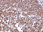 CD20/MS4A1 (B-Cell Marker) Antibody in Immunohistochemistry (Paraffin) (IHC (P))