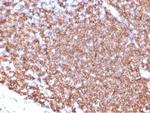 CD20/MS4A1 (B-Cell Marker) Monoclonal Antibody (MS4A1/4655)