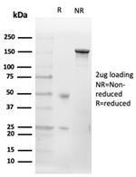 CD20/MS4A1 (B-Cell Marker) Antibody in Immunoelectrophoresis (IE)