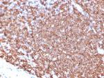 CD20/MS4A1 (B-Cell Marker) Antibody in Immunohistochemistry (Paraffin) (IHC (P))
