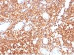 CD20/MS4A1 (B-Cell Marker) Antibody in Immunohistochemistry (Paraffin) (IHC (P))