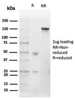 CD20/MS4A1 (B-Cell Marker) Antibody in SDS-PAGE (SDS-PAGE)