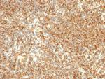 CD20/MS4A1 (B-Cell Marker) Antibody in Immunohistochemistry (Paraffin) (IHC (P))