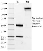 CD20/MS4A1 (B-Cell Marker) Antibody in SDS-PAGE (SDS-PAGE)