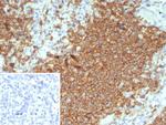 CD20/MS4A1 (B-Cell Marker) Antibody in Immunohistochemistry (Paraffin) (IHC (P))