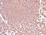 CD20/MS4A1 (B-Cell Marker) Antibody in Immunohistochemistry (Paraffin) (IHC (P))