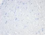 CD20/MS4A1 (B-Cell Marker) Antibody in Immunohistochemistry (Paraffin) (IHC (P))