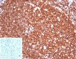 CD20/MS4A1 (B-Cell Marker) Antibody in Immunohistochemistry (Paraffin) (IHC (P))