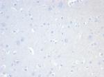CD20/MS4A1 (B-Cell Marker) Recombinant Rabbit Monoclonal Antibody (MS4A1/7015R)