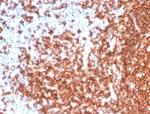 CD20/MS4A1 (B-Cell Marker) Antibody in Immunohistochemistry (Paraffin) (IHC (P))