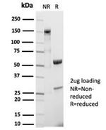 CD20/MS4A1 (B-Cell Marker) Antibody in Immunoelectrophoresis (IE)