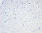 CD20/MS4A1 (B-Cell Marker) Antibody in Immunohistochemistry (Paraffin) (IHC (P))