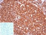 CD20/MS4A1 (B-Cell Marker) Antibody in Immunohistochemistry (Paraffin) (IHC (P))