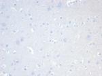 CD20/MS4A1 (B-Cell Marker) Recombinant Rabbit Monoclonal Antibody (MS4A1/7015R)