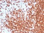 CD20/MS4A1 (B-Cell Marker) Antibody in Immunohistochemistry (Paraffin) (IHC (P))