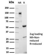 CD20/MS4A1 (B-Cell Marker) Antibody in SDS-PAGE (SDS-PAGE)