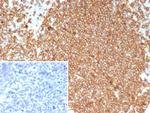 CD20/MS4A1 (B-Cell Marker) Antibody in Immunohistochemistry (Paraffin) (IHC (P))