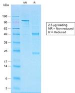 CD20/MS4A1 Antibody in SDS-PAGE (SDS-PAGE)