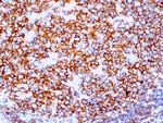 CD20/MS4A1 Recombinant Rabbit Monoclonal Antibody (IGEL, 1497R)