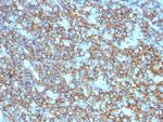 CD20/MS4A1 (B-Cell Marker) Antibody in Immunohistochemistry (Paraffin) (IHC (P))