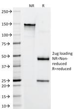 CD22/BL-CAM (B-Cell Marker) Antibody in SDS-PAGE (SDS-PAGE)