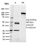 CD22/BL-CAM (B-Cell Marker) Antibody in SDS-PAGE (SDS-PAGE)