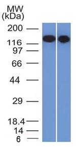CD22/BL-CAM Antibody in Western Blot (WB)