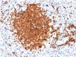 CD22/BL-CAM Antibody in Immunohistochemistry (Paraffin) (IHC (P))