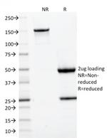 CD22/BL-CAM Antibody in SDS-PAGE (SDS-PAGE)
