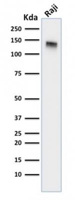 CD22/BL-CAM Antibody in Western Blot (WB)