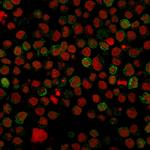 CD22/BL-CAM (B-Cell Marker) Antibody in Immunocytochemistry (ICC/IF)