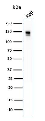 CD22/BL-CAM (B-Cell Marker) Antibody in Western Blot (WB)