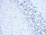 CD22/BL-CAM (B-Cell Marker) Antibody in Immunohistochemistry (Paraffin) (IHC (P))