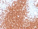CD22/BL-CAM (B-Cell Marker) Antibody in Immunohistochemistry (Paraffin) (IHC (P))