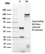 CD22/BL-CAM (B-Cell Marker) Antibody in SDS-PAGE (SDS-PAGE)