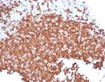 CD22/BL-CAM (B-Cell Marker) Antibody in Immunohistochemistry (Paraffin) (IHC (P))