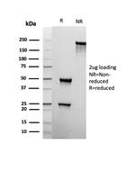 CD22/BL-CAM (B-Cell Marker) Antibody in SDS-PAGE (SDS-PAGE)