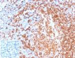 CD22/BL-CAM (B-Cell Marker) Antibody in Immunohistochemistry (Paraffin) (IHC (P))