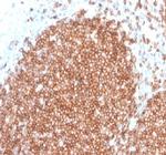 CD22/BL-CAM Antibody in Immunohistochemistry (Paraffin) (IHC (P))