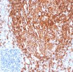 CD22/BL-CAM Recombinant Rabbit Monoclonal Antibody (BLCAM, 2637R)