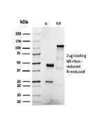 CD22/BL-CAM Antibody in SDS-PAGE (SDS-PAGE)